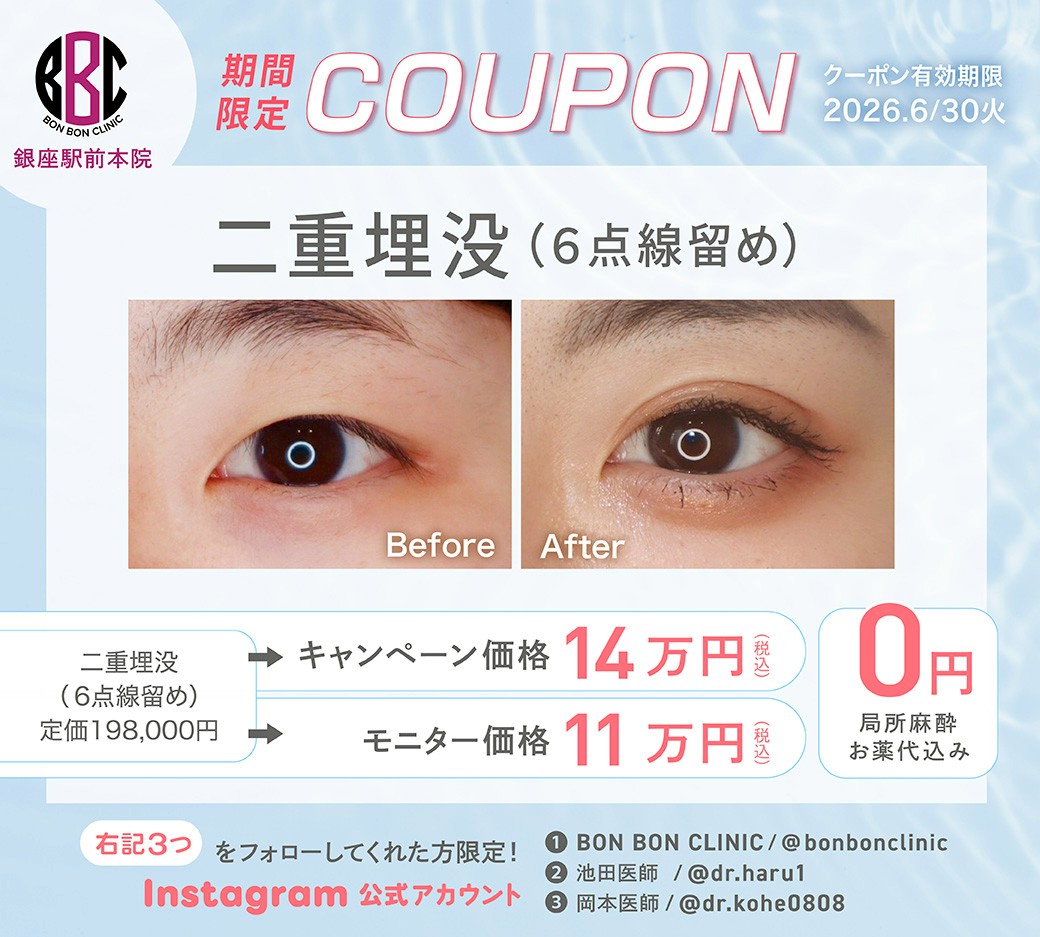 二重埋没法のクーポン画像