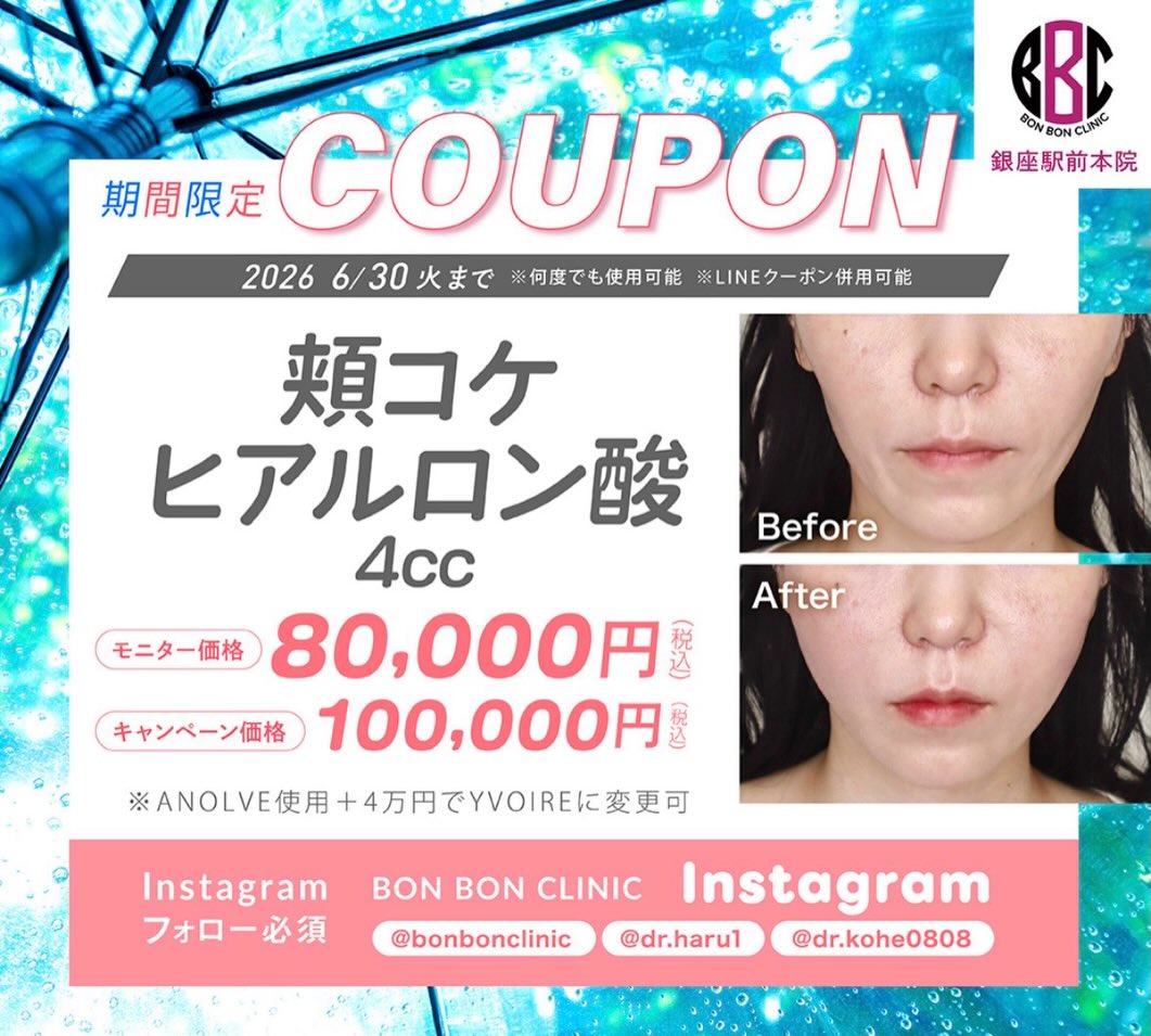 頬コケヒアルロン酸4ccのクーポン画像