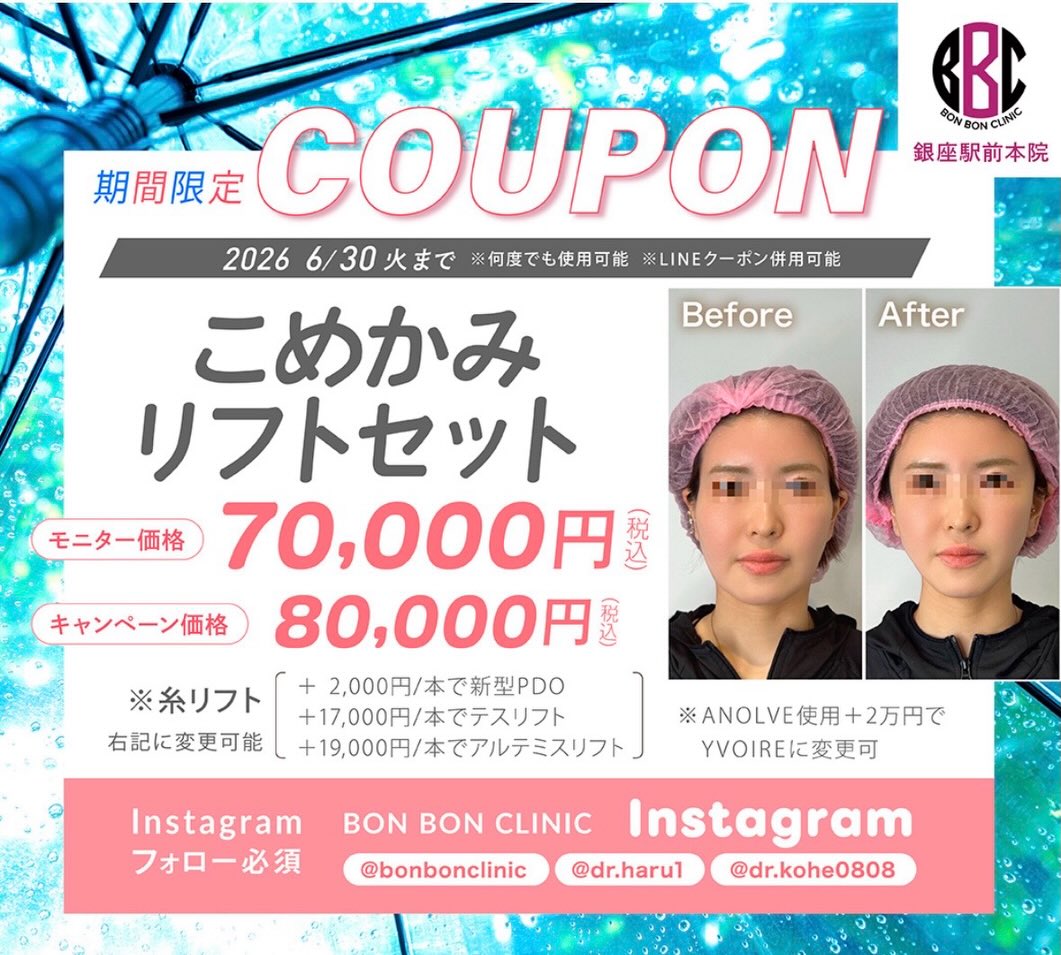 こめかみリフトのクーポン画像