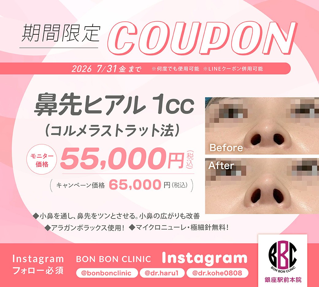 鼻先ヒアルロン酸1ccのクーポン画像