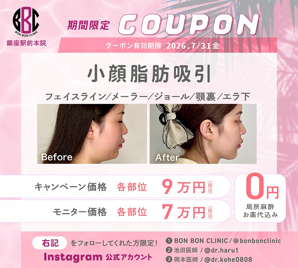 小顔脂肪吸引のクーポン画像