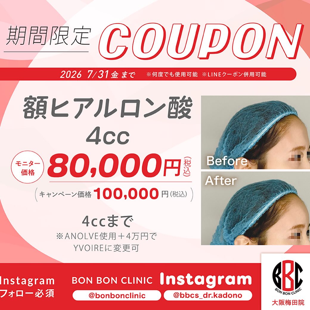 額ヒアルロン酸4ccのクーポン画像