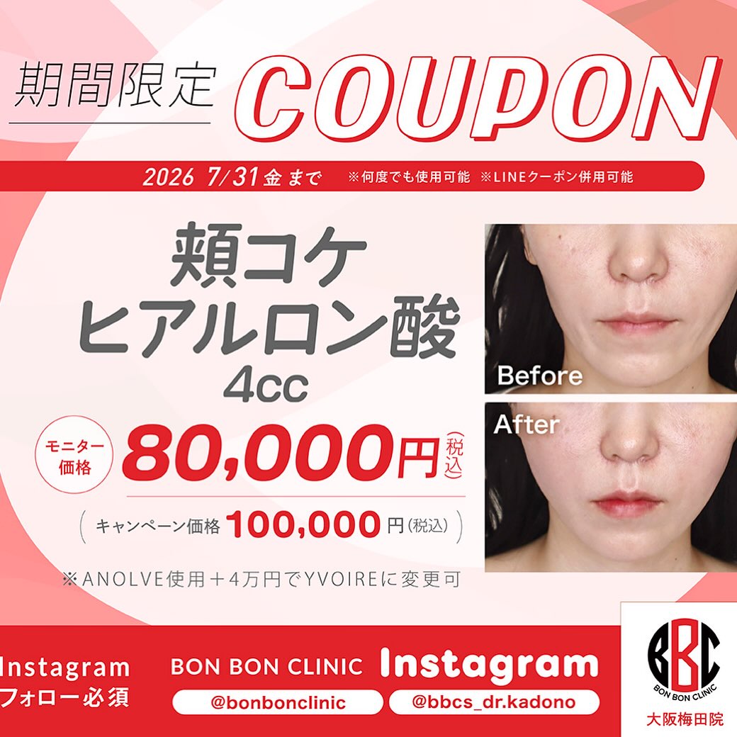 頬コケヒアルロン酸4ccのクーポン画像