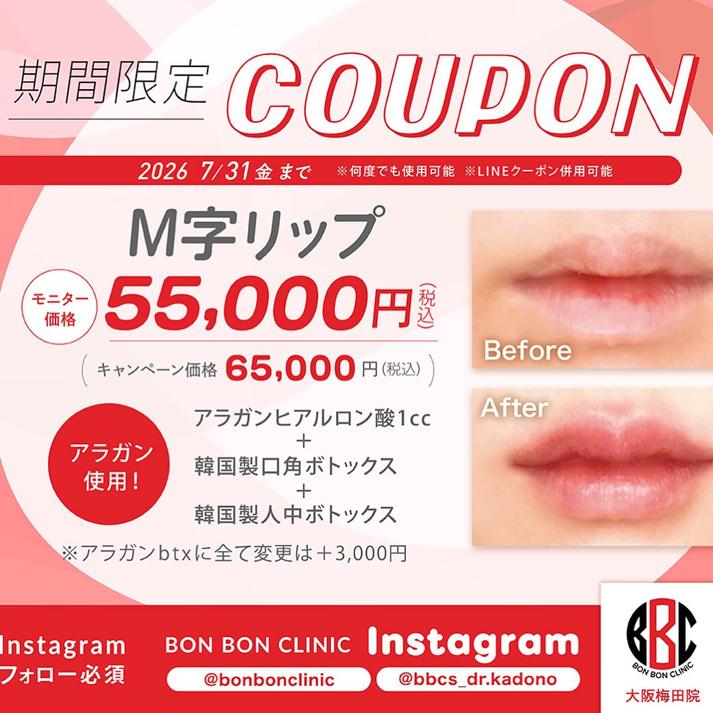 M字リップのクーポン画像