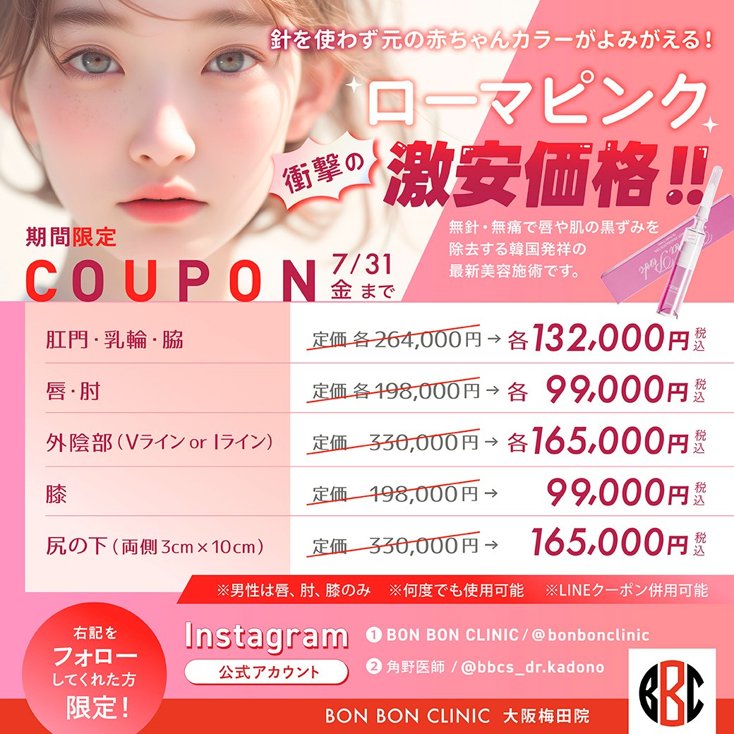 ローマピンクのクーポン画像
