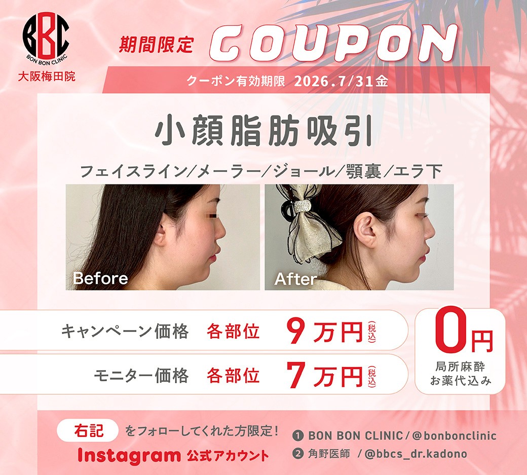 小顔脂肪吸引のクーポン画像