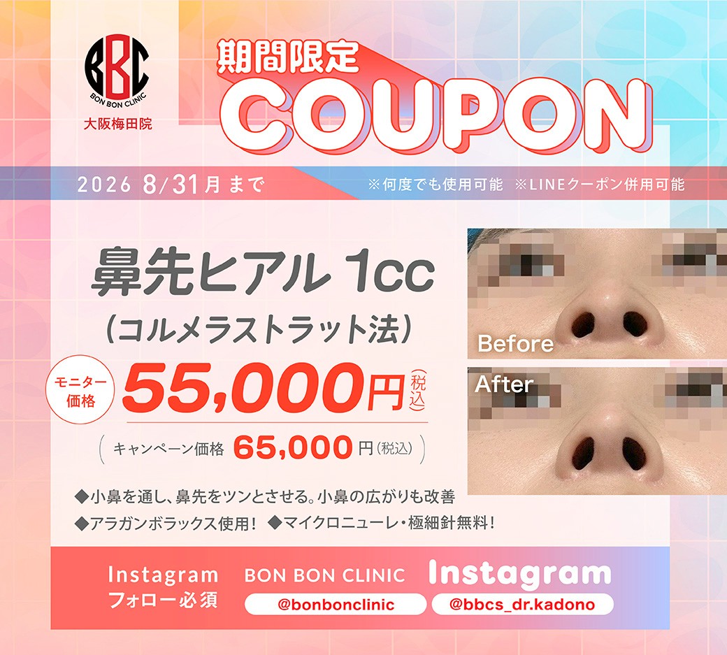 鼻先ヒアル1ccのクーポン画像