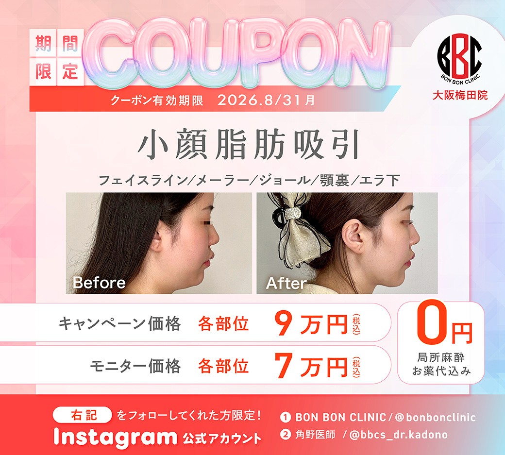 小顔脂肪吸引のクーポン画像