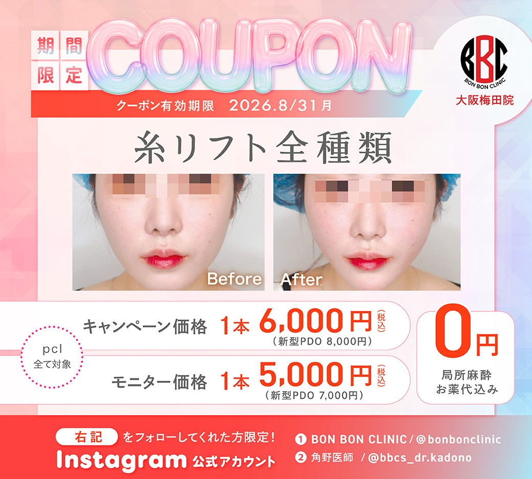 糸リフト全種類のクーポン画像