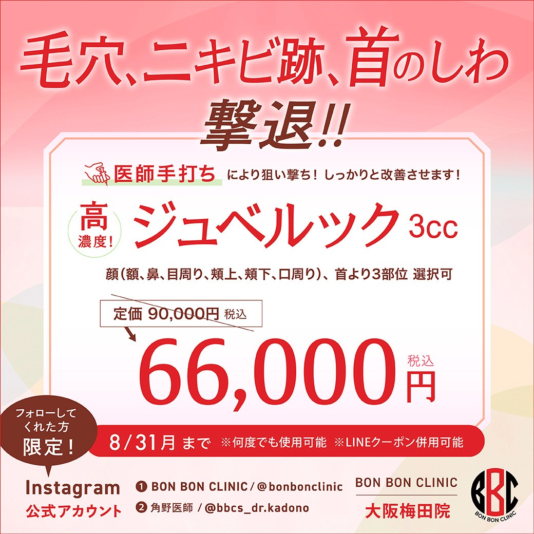 ジュベルックのクーポン画像