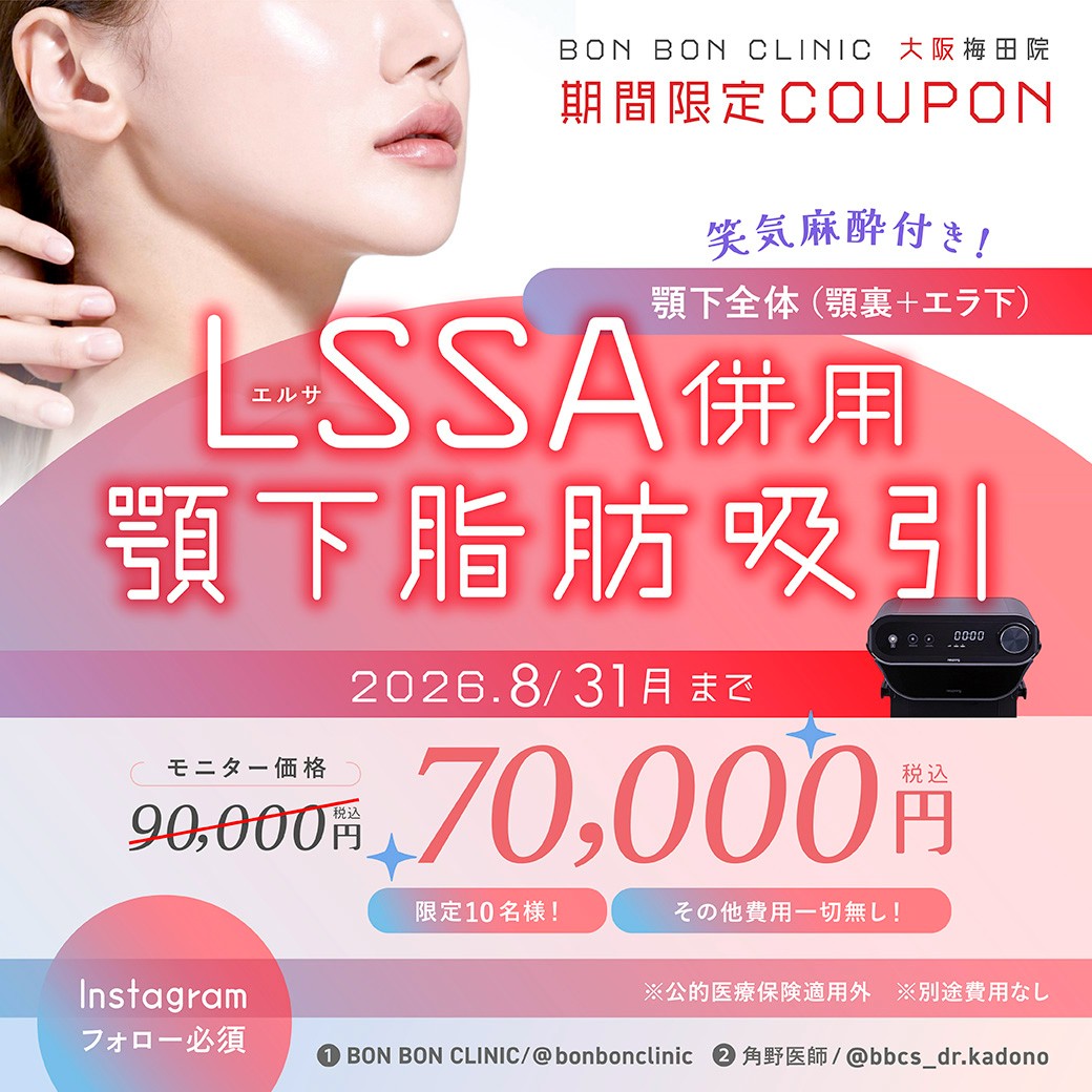 LSSA併用 顎下脂肪吸引キャンペーンのクーポン画像