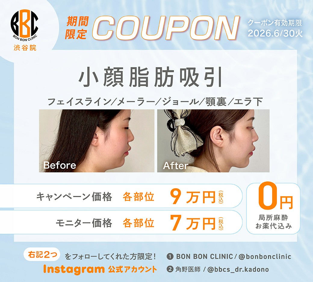小顔脂肪吸引のクーポン画像