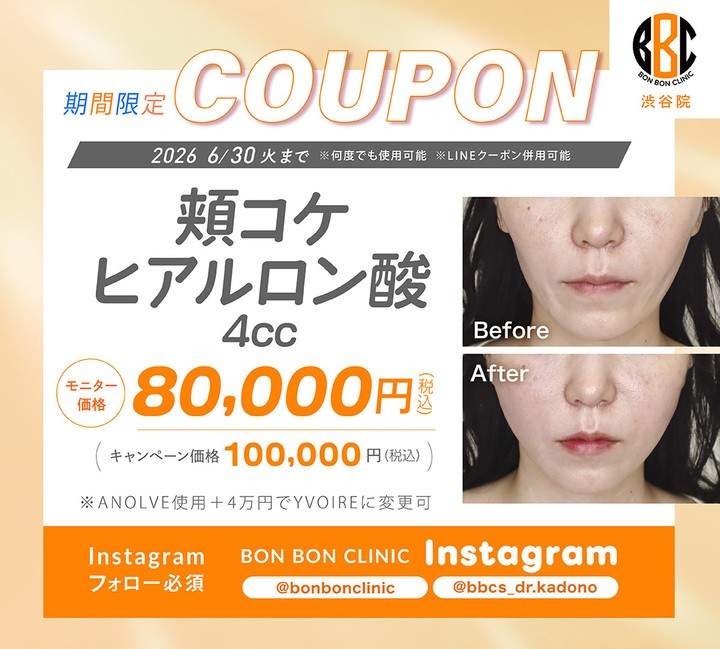 頬コケヒアルロン酸4ccのクーポン画像