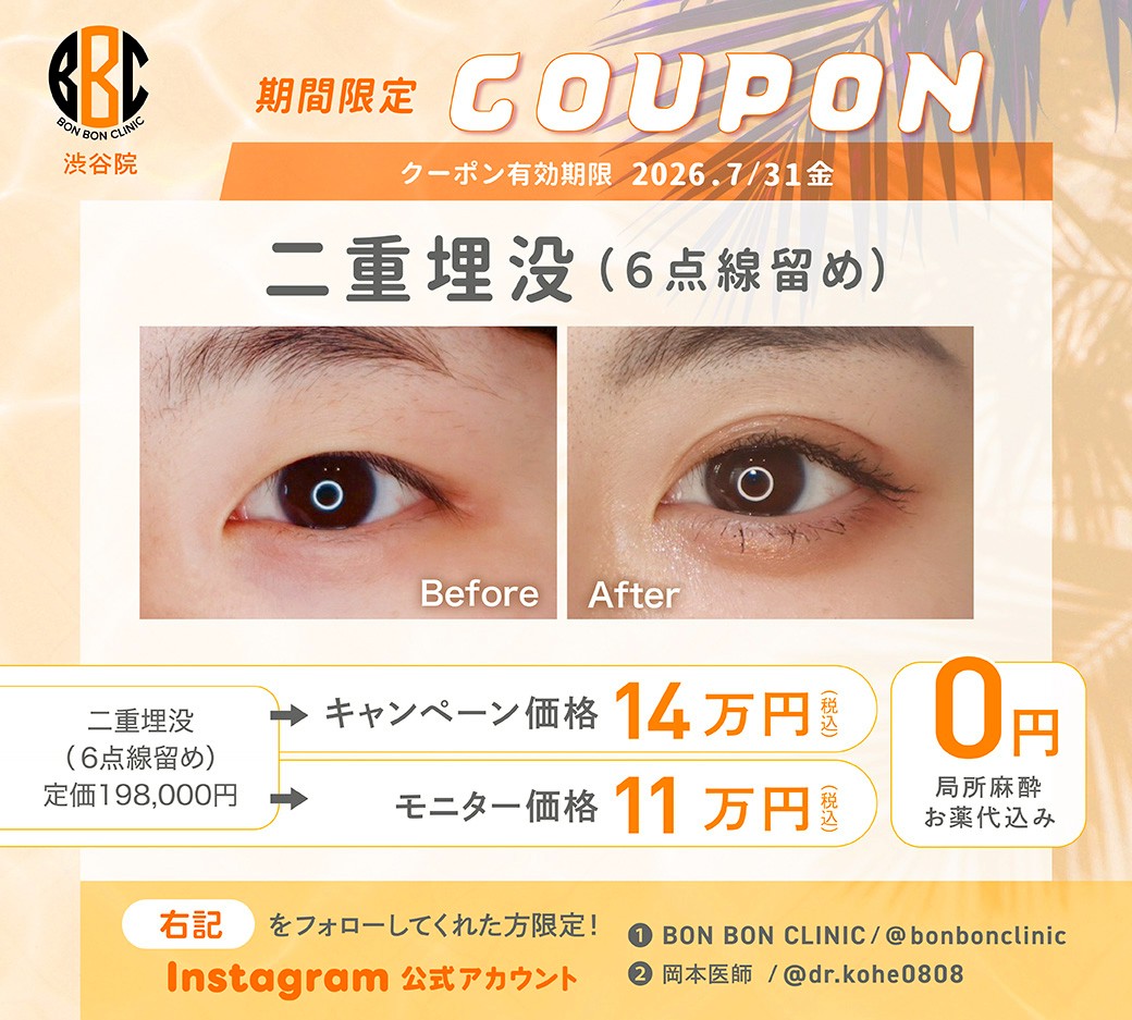 二重埋没のクーポン画像