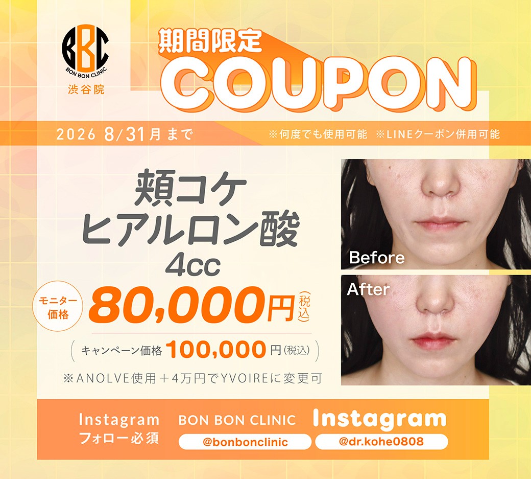 頬コケヒアルロン酸4ccのクーポン画像