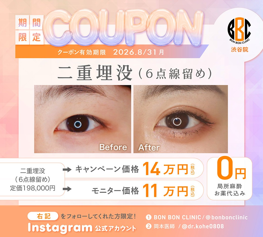 二重埋没のクーポン画像