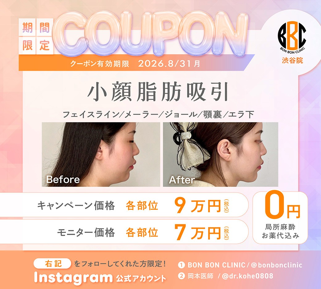 小顔脂肪吸引のクーポン画像