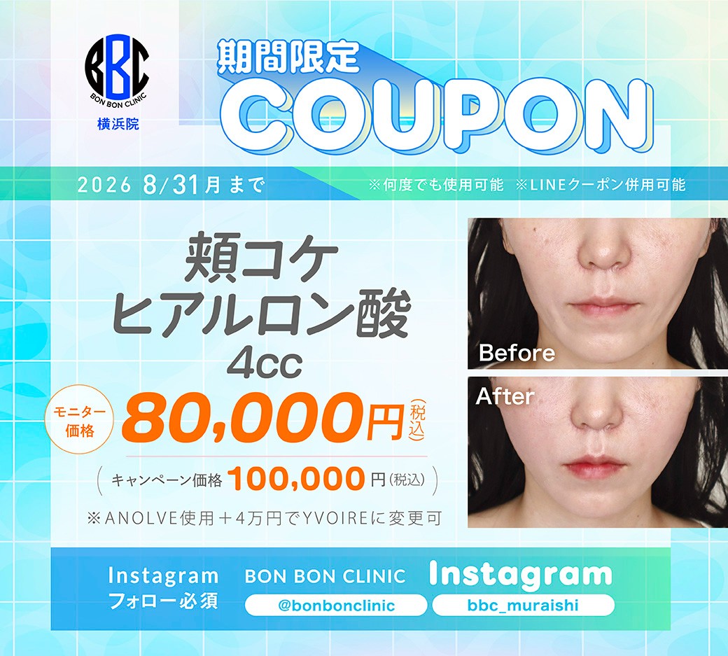 頬コケヒアルロン酸4ccのクーポン画像