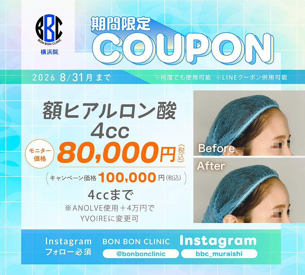 額ヒアルロン酸4ccのクーポン画像