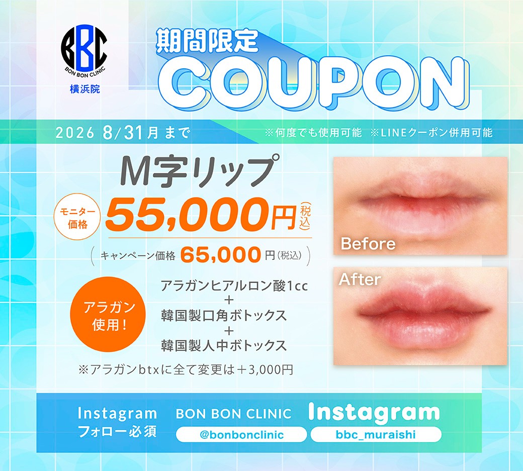 M字リップのクーポン画像