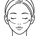 メニュー：アイリフトの画像