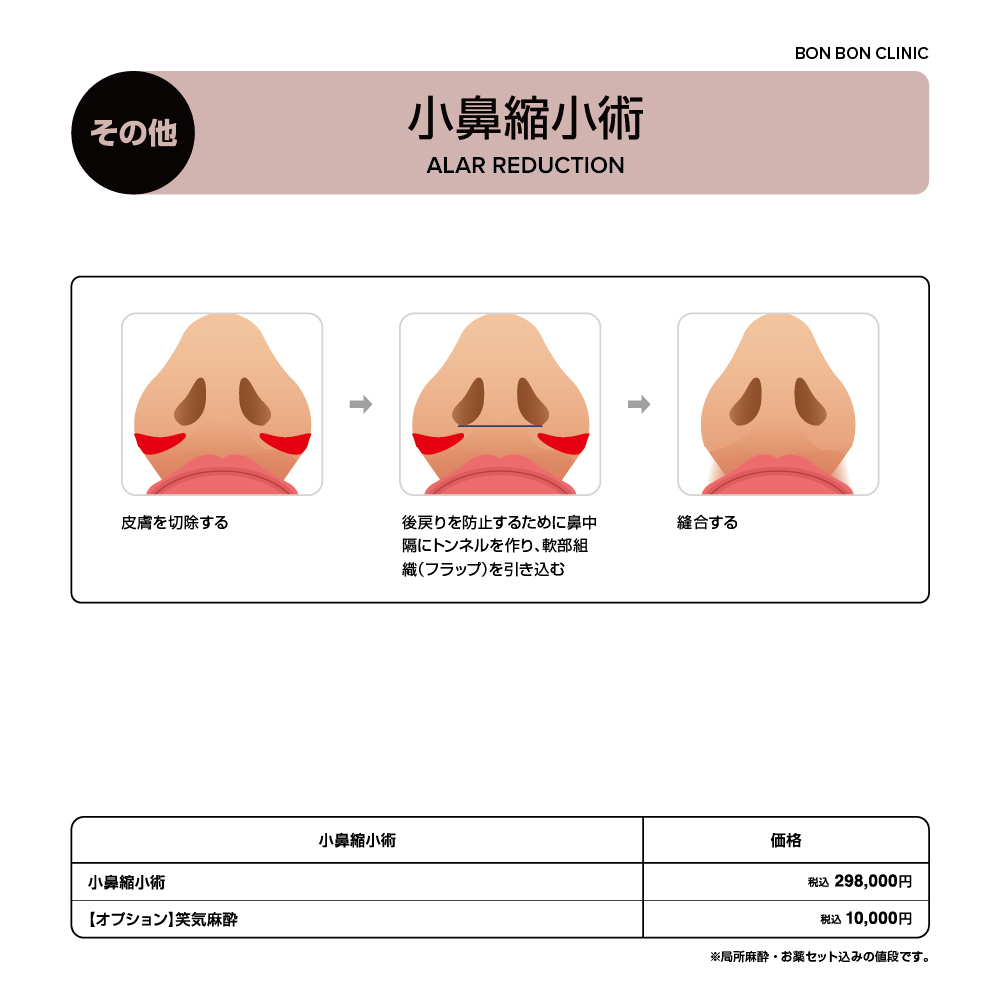 小鼻縮小術（外側法）ならボンボンクリニック 銀座駅前本院・渋谷院