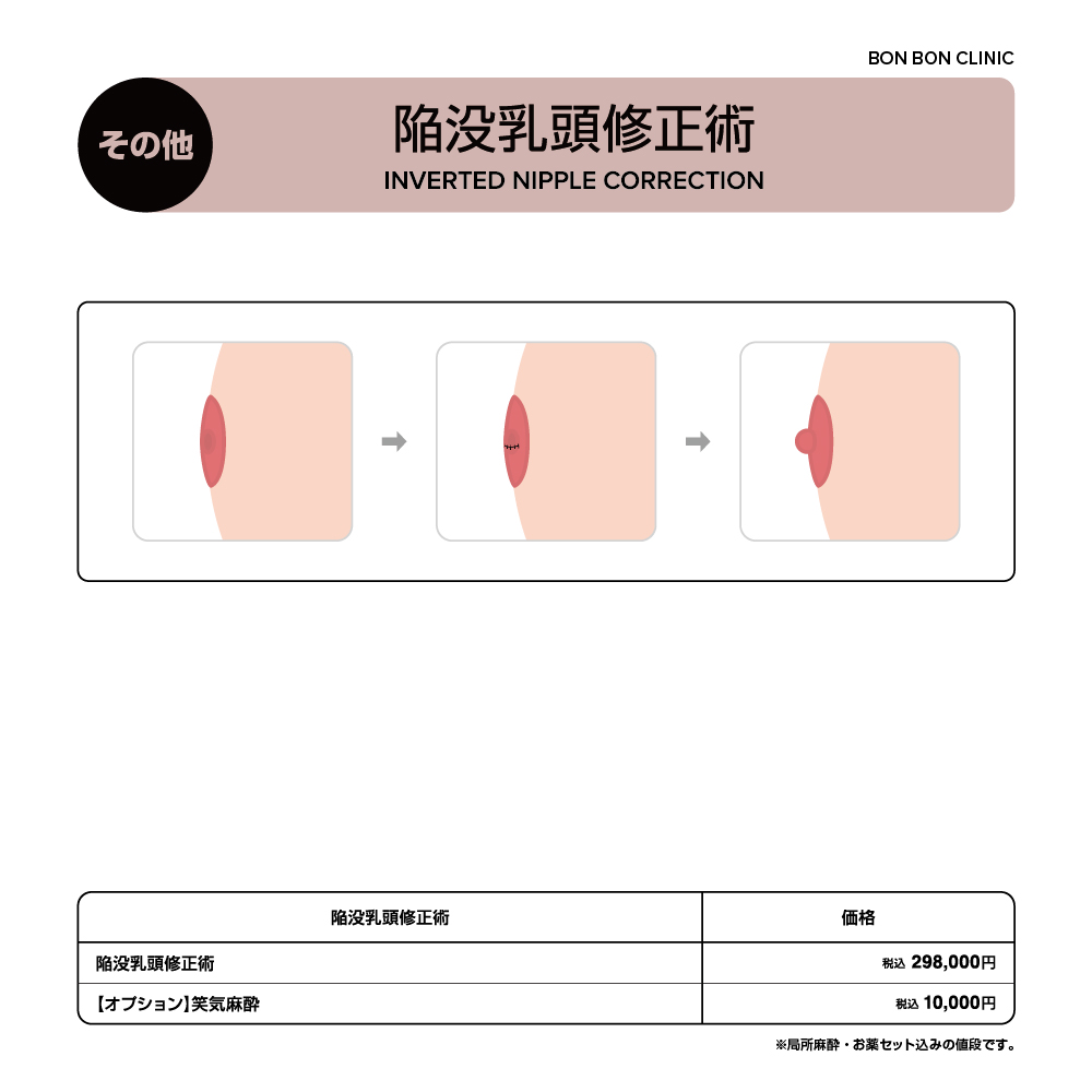 陥没乳頭修正術ならボンボンクリニック 銀座駅前本院・渋谷院