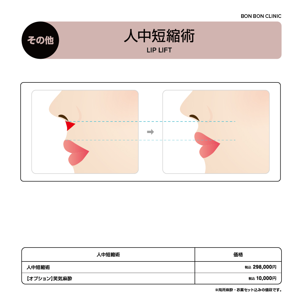 人中短縮術ならボンボンクリニック 銀座駅前本院・渋谷院