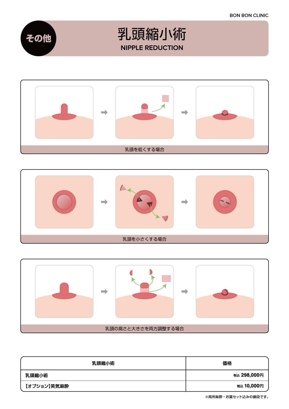 乳頭縮小術ならボンボンクリニック 銀座駅前本院・渋谷院