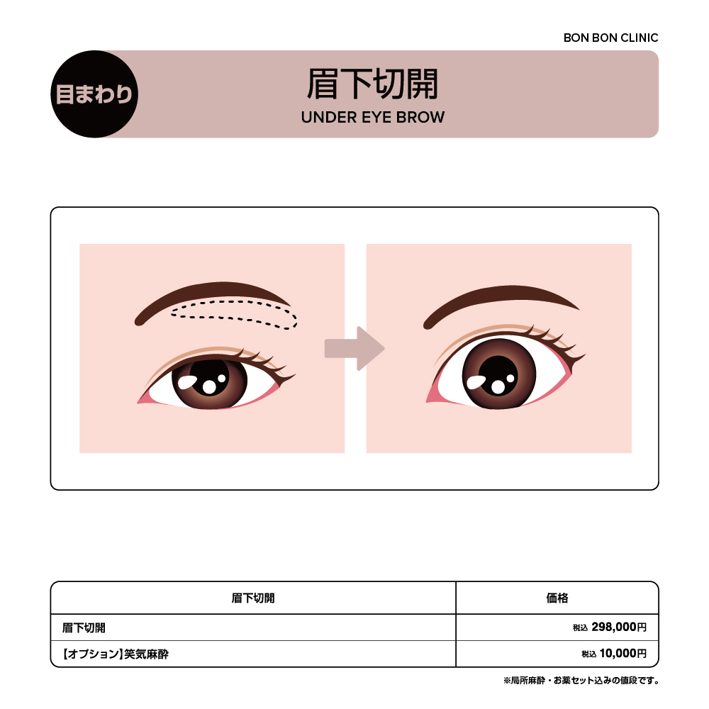 眉下切開ならボンボンクリニック 銀座駅前本院・渋谷院